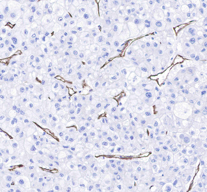 CD31 Recombinant Rabbit mAb,PBS Only (SDT-008-17)