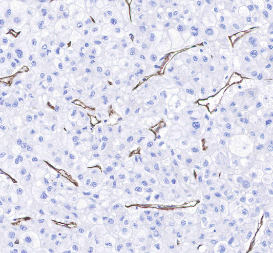 CD31 Recombinant Rabbit mAb,PBS Only (SDT-008-17)