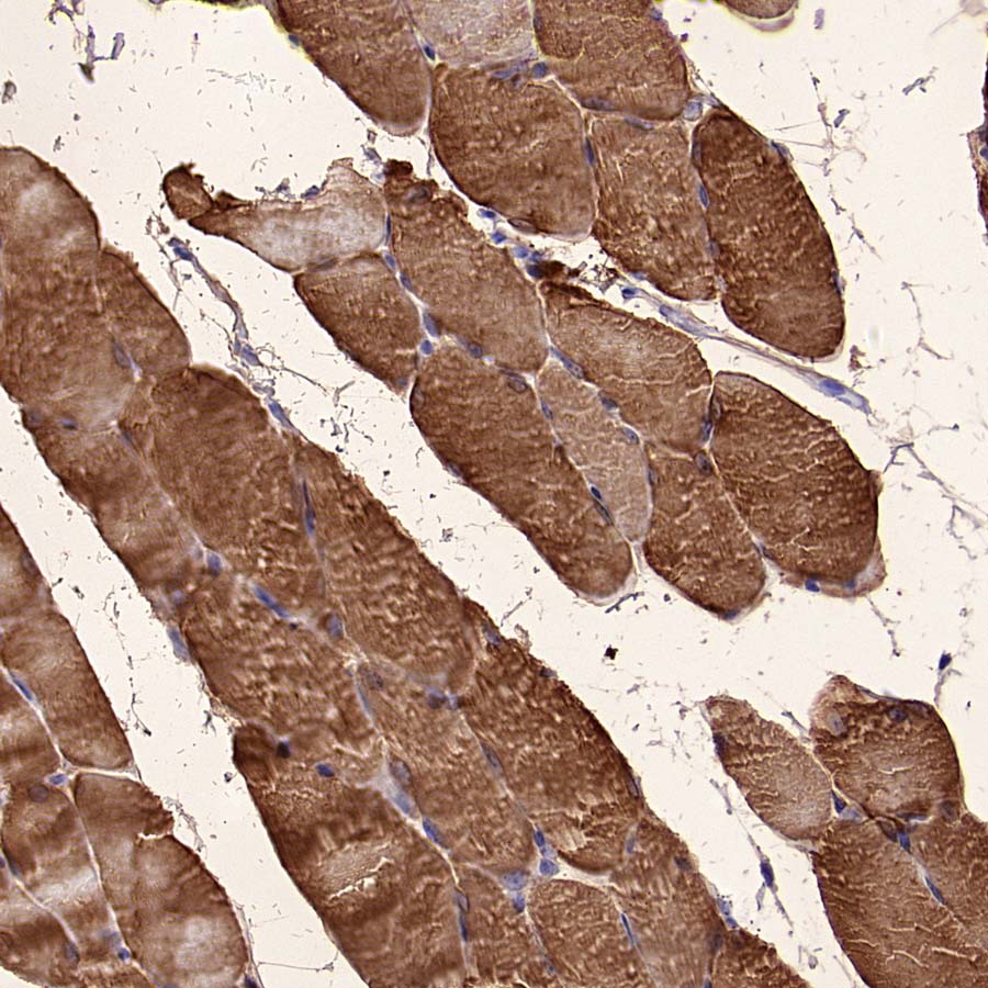 Aldolase A Recombinant Rabbit mAb (S-4007-23)