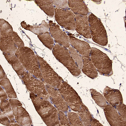Aldolase A Recombinant Rabbit mAb (S-4007-23)