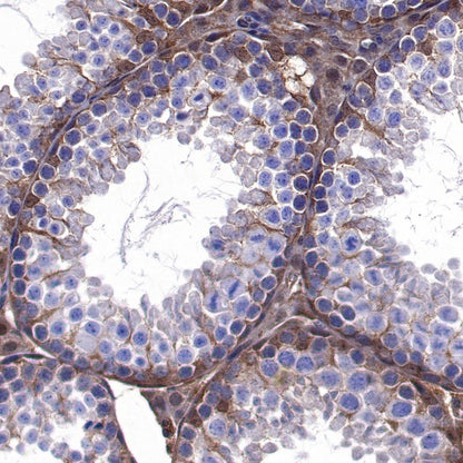 SH-PTP2 Recombinant Rabbit mAb (S-1318-2)