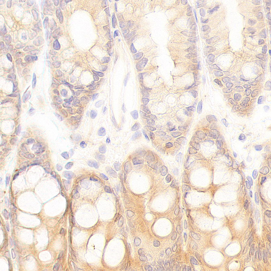 CDC42 Recombinant Rabbit mAb (S-6126)