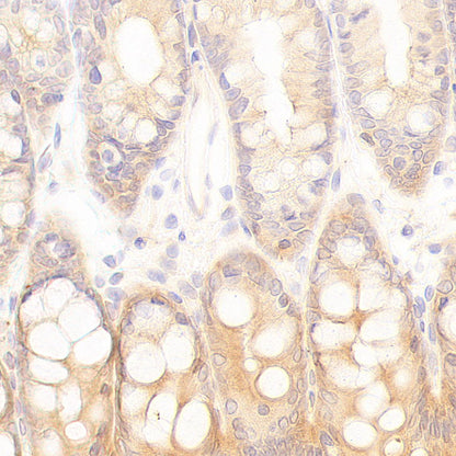 CDC42 Recombinant Rabbit mAb (S-6126)