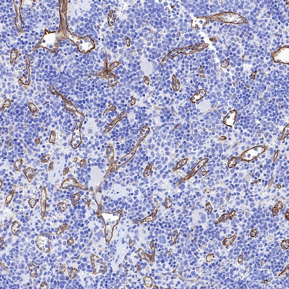 eNOS Recombinant Rabbit mAb (S-1885-94)