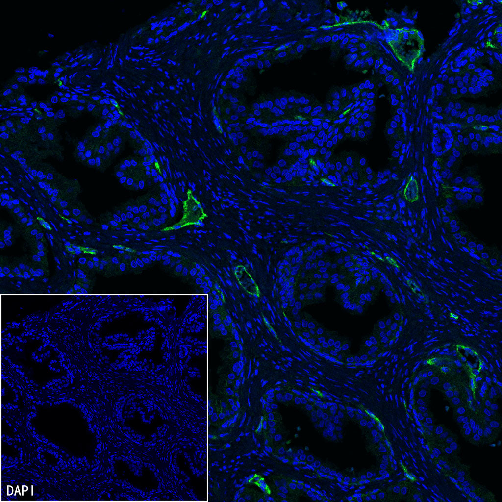 EPCR/PROCR (CD201) Rabbit Polyclonal Antibody