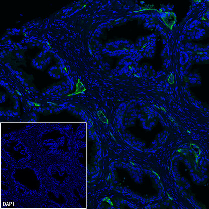 EPCR/PROCR (CD201) Rabbit Polyclonal Antibody