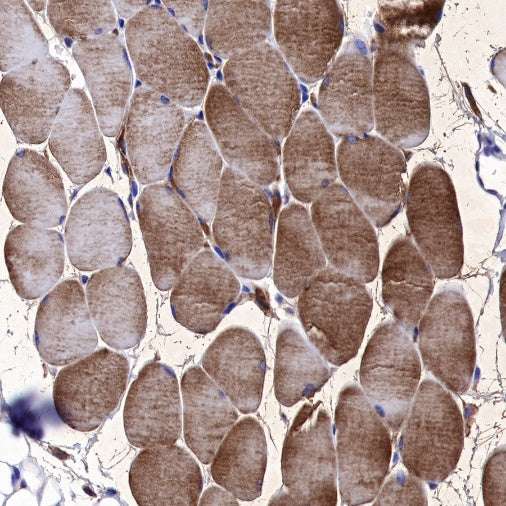 Neuropilin 1 Recombinant Rabbit mAb (S-1453-6)