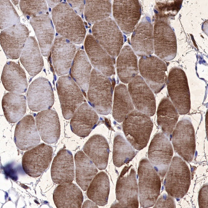 Neuropilin 1 Recombinant Rabbit mAb (S-1453-6)