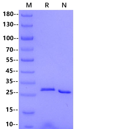 NNMT His Tag Protein, Rhesus macaque