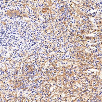Integrin alpha V Recombinant Rabbit mAb (S-1798-27)