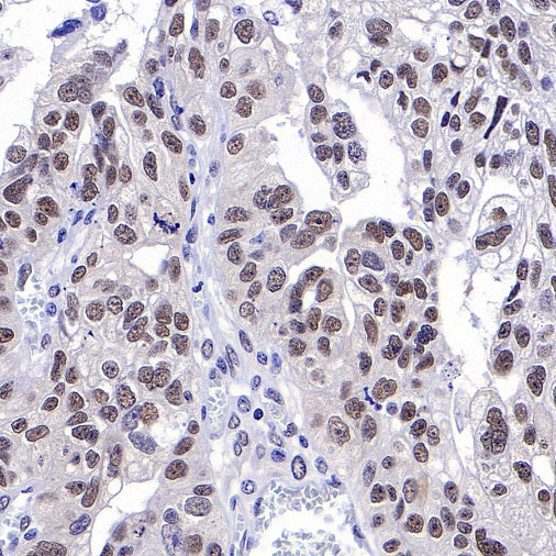 METTL3 Recombinant Rabbit mAb (S-315-219)