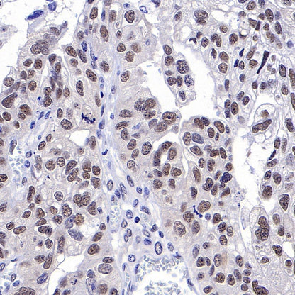 METTL3 Recombinant Rabbit mAb (S-315-219)