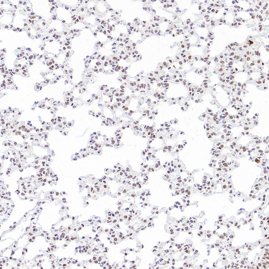 Phospho-STAT1 (Ser727) Recombinant Rabbit mAb