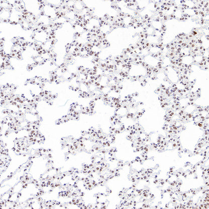 Phospho-STAT1 (Ser727) Recombinant Rabbit mAb