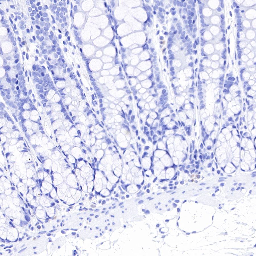alpha-actinin-2 Recombinant Rabbit mAb (SDT-032-79)
