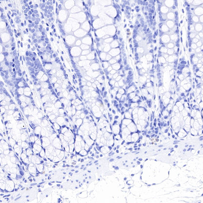 alpha-actinin-2 Recombinant Rabbit mAb (SDT-032-79)