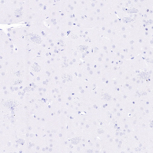 PAD4 Recombinant Rabbit mAb (SDT-2416-3)