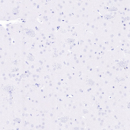 PAD4 Recombinant Rabbit mAb (SDT-2416-3)