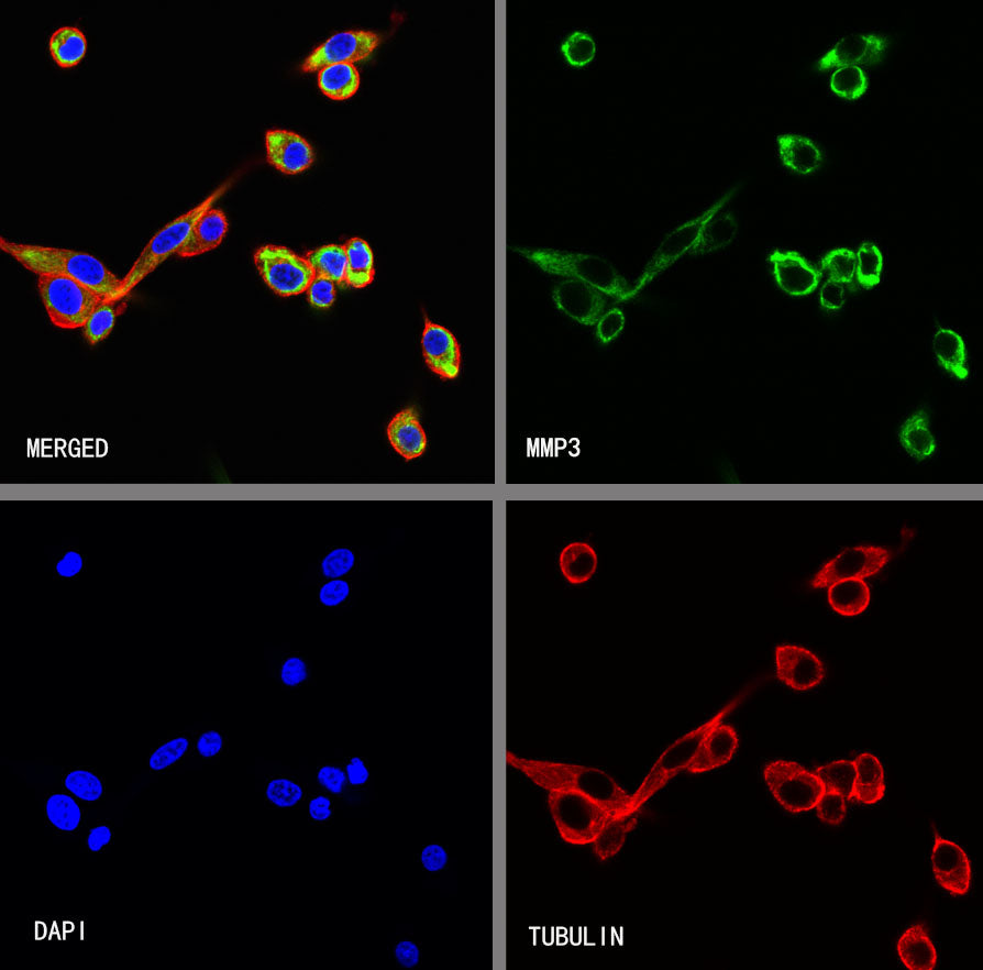 MMP3 Recombinant Rabbit mAb
