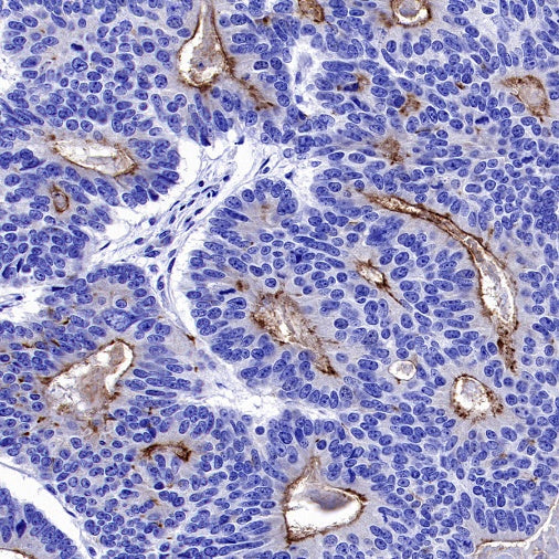 MRP2 Recombinant Rabbit mAb (S-2316-41)