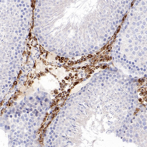 CYP11A1 Rabbit Polyclonal Antibody