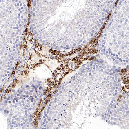 CYP11A1 Rabbit Polyclonal Antibody