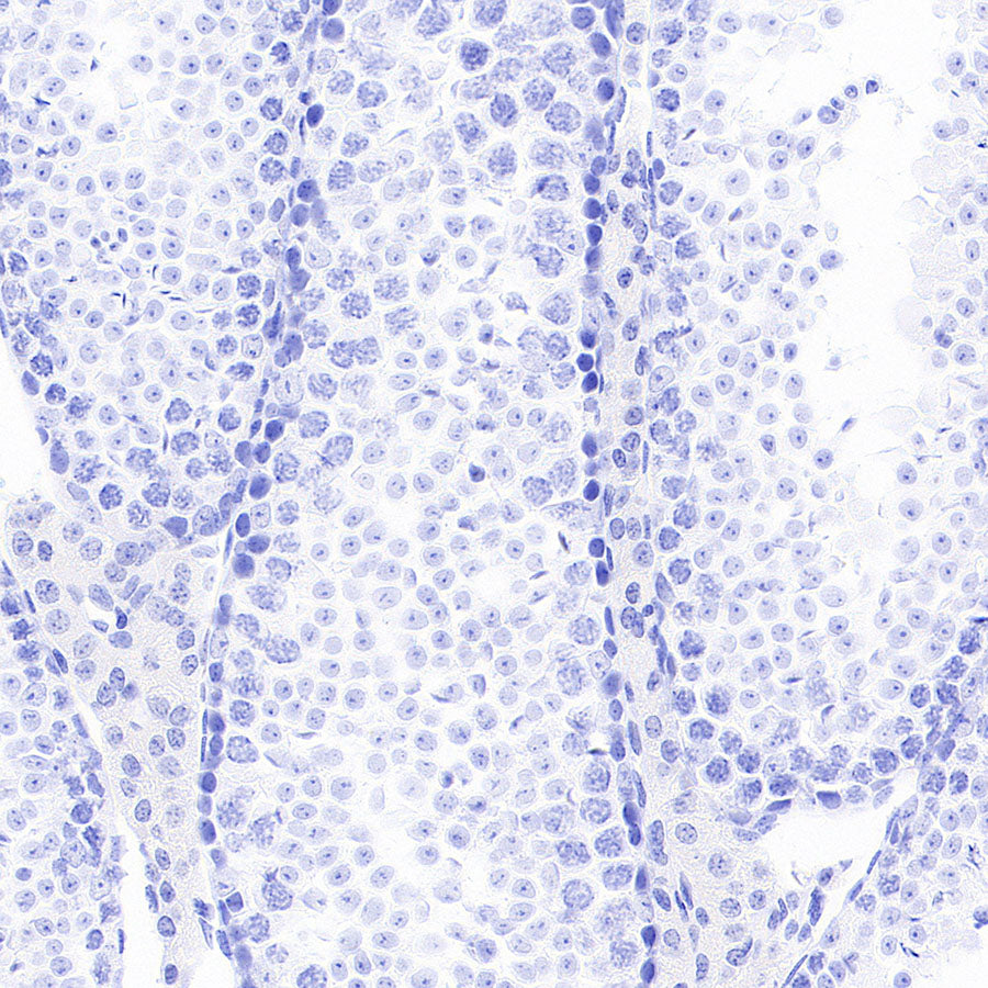 ITPR1 Recombinant Rabbit mAb (S-4530-5)