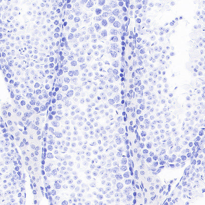 ITPR1 Recombinant Rabbit mAb (S-4530-5)