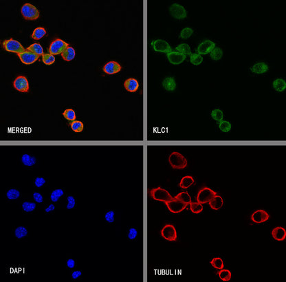 KLC1 Recombinant Rabbit mAb (S-4556-8)