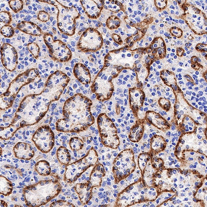 ICAM-2 Recombinant Rabbit mAb (S-R359)