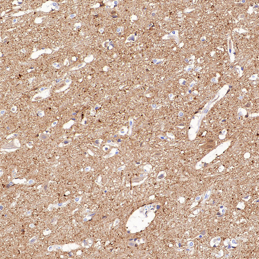 PGP9.5 Recombinant Mouse mAb (S-6071)