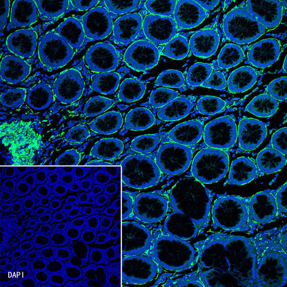 alpha smooth muscle Actin Recombinant Rabbit mAb (FITC Conjugate) (SDT-132-63)