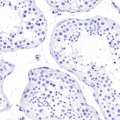 SOX17 Recombinant Rabbit mAb (SDT-1803-48)