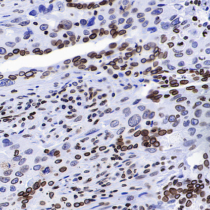 Lamin B1 Recombinant Rabbit mAb (S-5361)
