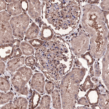 Ubiquitin Rabbit mAb (SDT-R095)