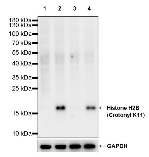 Histone H2B (Crotonyl K11) Recombinant Rabbit mAb (S-R420)