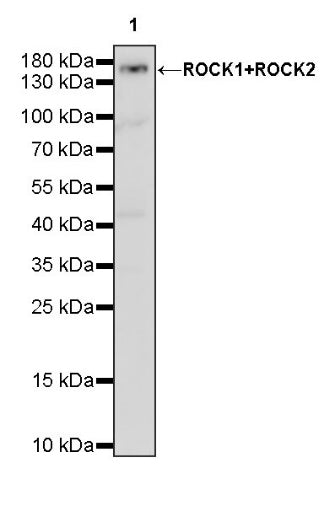 ROCK1+ROCK2 Recombinant Rabbit mAb (S-1305-26)