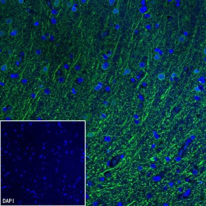 MAP2 Recombinant Rabbit mAb, PBS Only (SDT-2060-28)