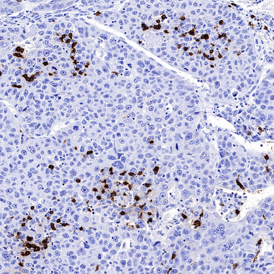 S-RMab® CD20 Recombinant Rabbit mAb,PBS Only (SDT-R133)