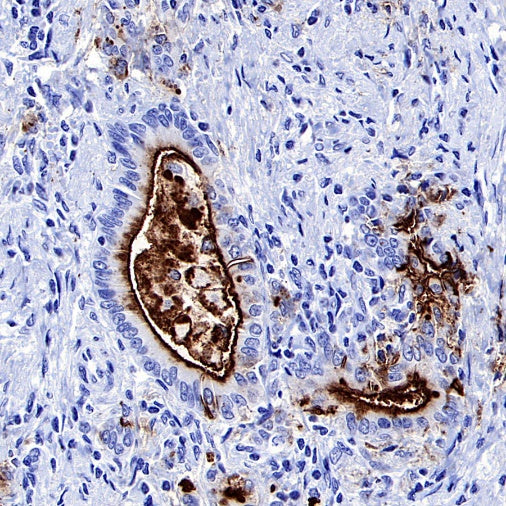 MUC1/EMA Mouse mAb (SDT-777-37)