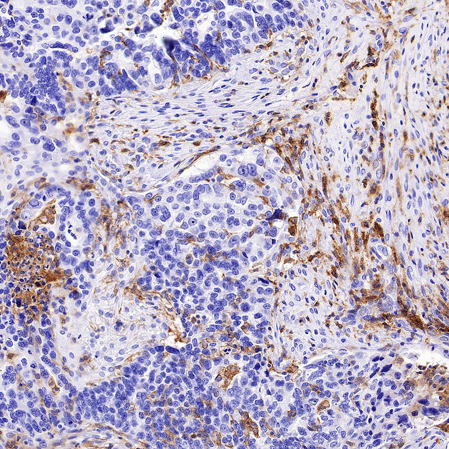LILRB1 Recombinant Rabbit mAb (S-5001)