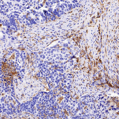 LILRB1 Recombinant Rabbit mAb (S-5001)