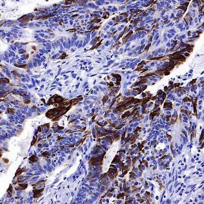 CK7/8 Recombinant Rabbit mAb (SDT-P006)