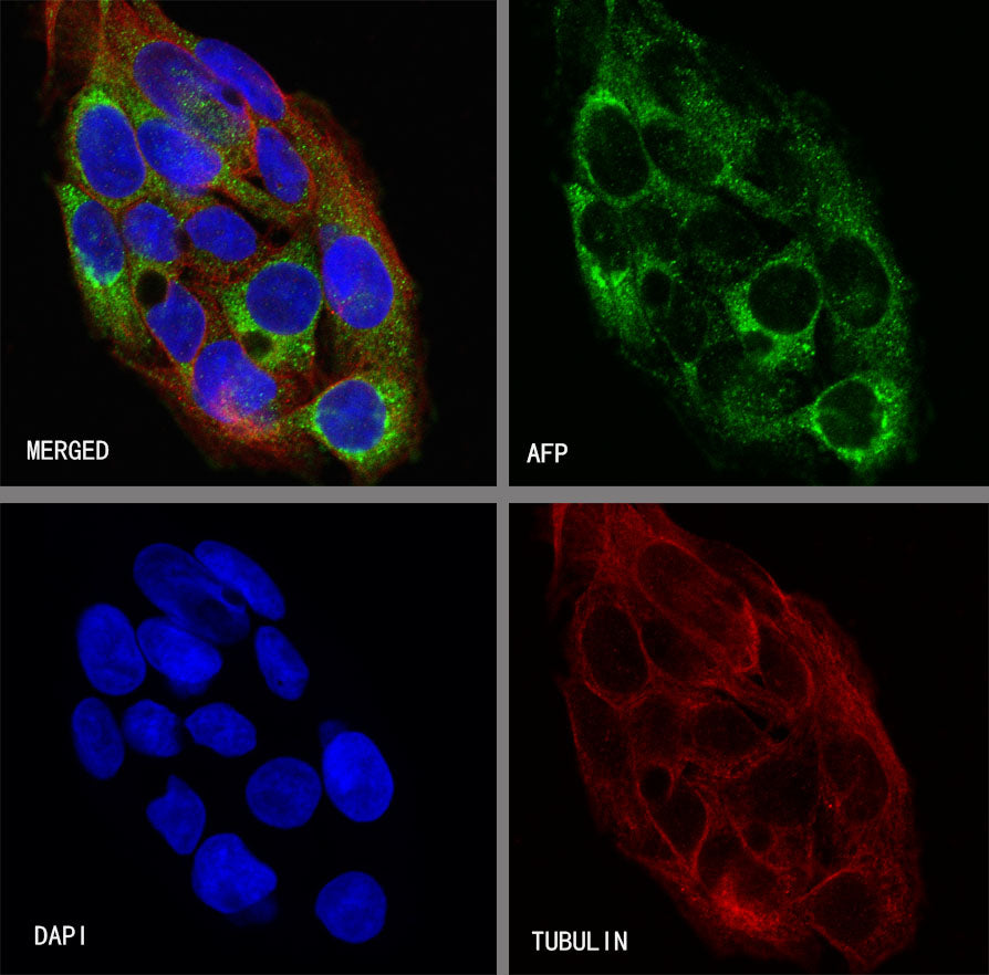 AFP Recombinant Rabbit mAb (SDT-R031)