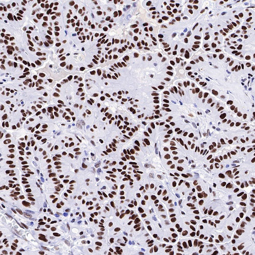 Nog1 Recombinant Rabbit mAb (S-R330)