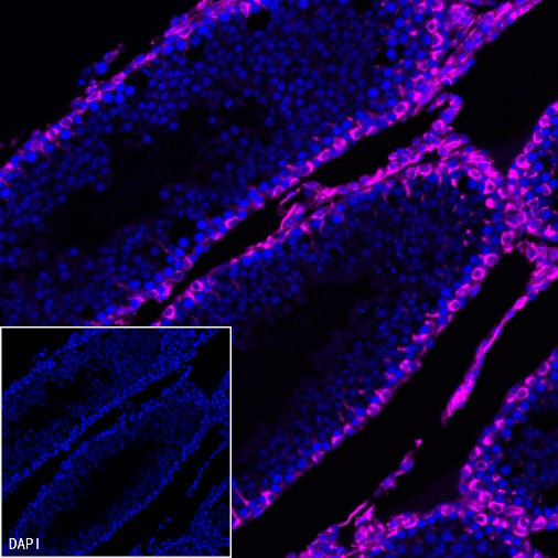 Vimentin Recombinant Rabbit mAb (Alexa Fluor® 647 Conjugate) (S-029-20)