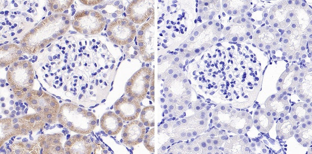 Phospho-GCN2 (T899) Recombinant Rabbit mAb (S-1665-19)