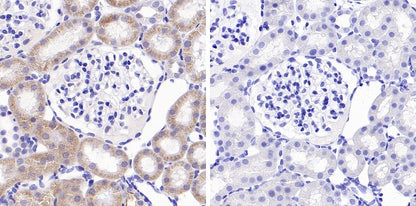 Phospho-GCN2 (T899) Recombinant Rabbit mAb (S-1665-19)