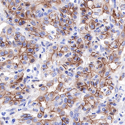 S-RMab® E-Cadherin Recombinant Rabbit mAb (SDT-R088)