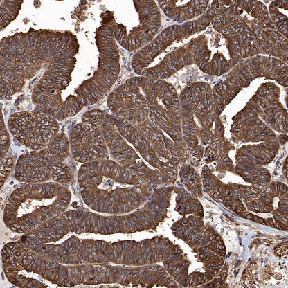 CAD/BM1 Recombinant Rabbit mAb (S-1650-72)